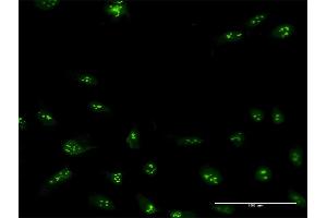 Immunofluorescence of purified MaxPab antibody to NIP7 on HeLa cell. (NIP7 Antikörper  (AA 1-180))
