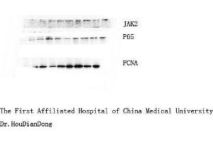 Western Blot (WB) analysis: Please contact us for more details. (NF-kB p65 Antikörper)