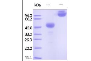 Cynomolgus CTLA-4, Fc Tag on SDS-PAGE under reducing (R) and no-reducing (NR) conditions.