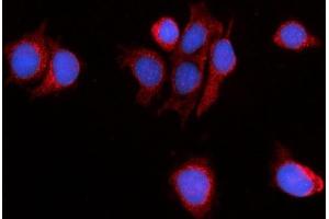 IF analysis of PDE4DIP using anti-PDE4DIP antibody (ABIN7602691). (PDE4DIP Antikörper  (AA 96-1254))