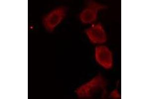 ABIN6276233 staining RAW264. (AVPR2 Antikörper  (Internal Region))