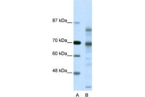 Western Blotting (WB) image for anti-Nuclear Receptor Co-Repressor 2 (NCOR2) antibody (ABIN2460475) (NCOR2 Antikörper)