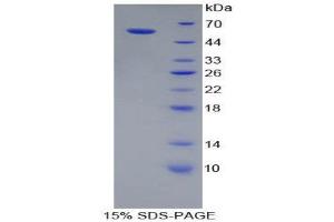 SDS-PAGE (SDS) image for Cathepsin A (CTSA) (AA 151-394) protein (His tag,GST tag) (ABIN2122575) (CTSA Protein (AA 151-394) (His tag,GST tag))