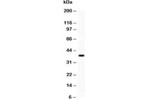 Western blot testing of SIRT1 antibody and recombinant human protein (0.