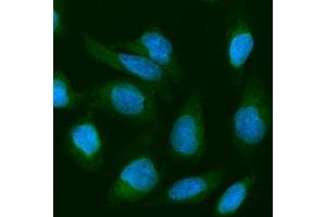 IF analysis of Cofilin 2 using anti-Cofilin 2 antibody (ABIN4886538). (Cofilin 2 Antikörper  (C-Term))