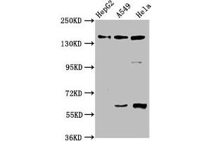 NAIP anticorps  (AA 147-242)