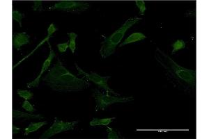 Immunofluorescence of monoclonal antibody to IRAK4 on HeLa cell. (IRAK4 Antikörper  (AA 255-351))