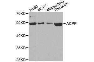 Western blot analysis of extracts of various cell lines, using ACPP antibody. (ACPP Antikörper  (AA 40-300))