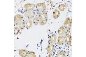 Immunohistochemistry of paraffin-embedded human stomach using YAP1 antibody. (YAP1 Antikörper)