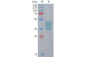 SDS-PAGE (SDS) image for Chemokine (C-C Motif) Receptor 2 (CCR2) (AA 1-55) protein (Fc Tag) (ABIN7538184)
