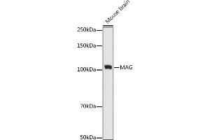 Western blot analysis of extracts of Mouse brain cells, using MAG antibody (ABIN7268718) at 1:1000 dilution. (MAG Antikörper)