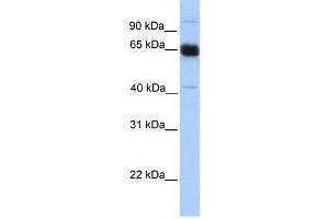 PRKAA1 antibody used at 1 ug/ml to detect target protein. (PRKAA1 Antikörper  (N-Term))