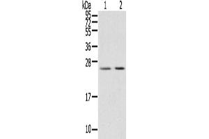 Gel: 12 % SDS-PAGE, Lysate: 40 μg, Lane 1-2: Human breast infiltrative duct tissue, Human placenta tissue, Primary antibody: ABIN7191460(MIG7 Antibody) at dilution 1/200, Secondary antibody: Goat anti rabbit IgG at 1/8000 dilution, Exposure time: 15 seconds (TOX4 Antikörper)