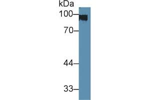 Western blot analysis of Rat Skin lysate, using Rabbit Anti-Mouse KRT1 Antibody (3 µg/ml) and HRP-conjugated Goat Anti-Rabbit antibody (abx400043, 0. (Cytokeratin 1 Antikörper  (AA 189-497))