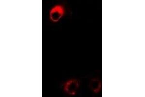 Immunofluorescent analysis of DDAH2 staining in Hela cells. (DDAH2 Antikörper)