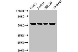 Western Blot Positive WB detected in: HepG2 whole cell lysate, Jurkat whole cell lysate, HEK293 whole cell lysate, SH-SY5Y whole cell lysate All lanes: DCTN4 antibody at 3. (Dynactin 4 Antikörper  (AA 2-460))