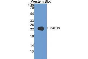 Western blot analysis of the recombinant protein. (Coagulation Factor V Antikörper  (AA 1941-2095))