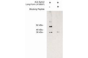 Image no. 1 for anti-Sphingosine Kinase 2 (SPHK2) (Long Isoform), (N-Term) antibody (ABIN4620350) (SPHK2 Antikörper  (Long Isoform, N-Term))