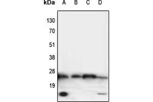 Western blot analysis of TNF alpha expression in HeLa (A), NIH3T3 (B), mouse heart (C), rat brain (D) whole cell lysates. (TNF alpha Antikörper  (Center))