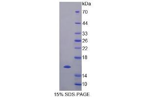 SDS-PAGE analysis of Human ELOC Protein. (TCEB1 Protein)