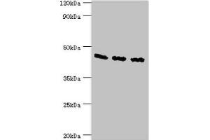 Western blot All lanes: Flotillin-2 antibody at 4 μg/mL Lane 1: A549 whole cell lysate Lane 2: Hela whole cell lysate Lane 3: Rat brain tissue Secondary Goat polyclonal to rabbit IgG at 1/10000 dilution Predicted band size: 47 kDa Observed band size: 47 kDa (Flotillin 2 Antikörper  (AA 239-428))