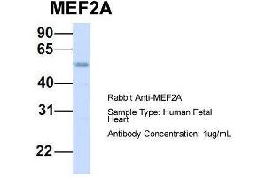 Host:  Rabbit  Target Name:  MEF2A  Sample Type:  Human Fetal Heart  Antibody Dilution:  1. (MEF2A Antikörper  (Middle Region))