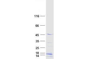 Validation with Western Blot (MAGEB18 Protein (Myc-DYKDDDDK Tag))