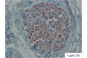 Image no. 1 for anti-Peripheral Myelin Protein 22 (PMP22) (Extracellular Domain) antibody (ABIN960672)