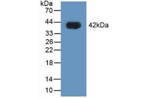 Detection of Recombinant HNRPA1, Human using Polyclonal Antibody to Heterogeneous Nuclear Ribonucleoprotein A1 (HNRNPA1)