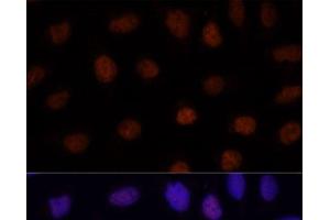 Immunofluorescence analysis of U-2 OS cells using GLI2 Polyclonal Antibody at dilution of 1:100.