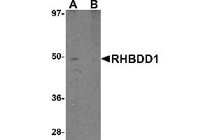 Western blot analysis of RHBDD1 in K562 cell lysate with RHBDD1 antibody at 1 µg/mL in (A) the absence and (B) the presence of blocking peptide. (RHBDD1 Antikörper  (C-Term))
