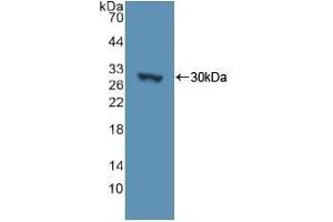 Detection of Recombinant ADCY3, Human using Polyclonal Antibody to Adenylate Cyclase 3 (ADCY3) (ADCY3 Antikörper  (AA 501-736))