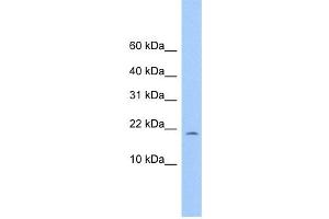 WB Suggested Anti-C10orf83 Antibody Titration: 0.