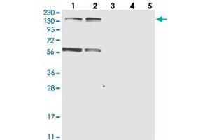 Western blot analysis of Lane 1: RT-4, Lane 2: U-251 MG, Lane 3: Human Plasma, Lane 4: Liver, Lane 5: Tonsil with KIF4A polyclonal antibody  at 1:250-1:500 dilution.