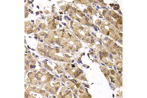 Immunohistochemistry of paraffin-embedded human gastric injury using ASMTL antibody (ABIN5975463) at dilution of 1/100 (40x lens). (ASMTL Antikörper)