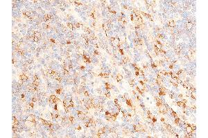 ABIN6267224 at 1/100 staining human appendiceal tissue sections by IHC-P. (CHEK1 Antikörper  (pSer317))