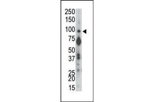 The anti-PTPalpha N-term Pab (ABIN392834 and ABIN2842259) is used in Western blot to detect PTPalpha in mouse brain tissue lysate.