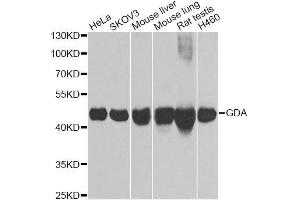 Western blot analysis of extracts of various cell lines, using GDA Antibody. (GDA Antikörper  (AA 165-454))