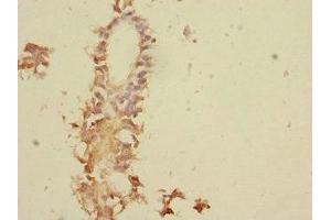 Immunohistochemistry (IHC) image for anti-Tumor Necrosis Factor, alpha-Induced Protein 8 (TNFAIP8) (AA 1-198) antibody (ABIN7173776)