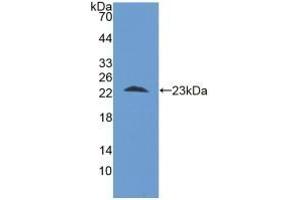 Detection of Recombinant STIP1, Human using Polyclonal Antibody to Stress Induced Phosphoprotein 1 (STIP1) (STIP1 Antikörper  (AA 1-169))
