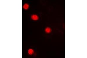 Immunofluorescent analysis of MAPKAPK3 staining in Hela cells. (MAPKAP Kinase 3 Antikörper  (C-Term))