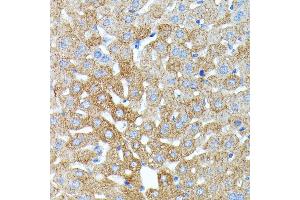 Immunohistochemistry of paraffin-embedded mouse liver using Haptoglobin (Haptoglobin (HP)) antibody (ABIN3022157, ABIN3022158, ABIN1513029, ABIN1514188 and ABIN6218636) at dilution of 1:100 (40x lens). (Haptoglobin Antikörper)