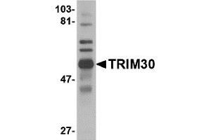 Western Blotting (WB) image for anti-Tripartite Motif Containing 30 (Trim30) (C-Term) antibody (ABIN1030773)