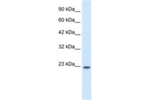 Western Blotting (WB) image for anti-Homeobox B6 (HOXB6) antibody (ABIN2460208) (HOXB6 Antikörper)