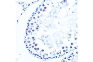 Immunohistochemistry of paraffin-embedded rat testis using DNA Polymerase beta Rabbit mAb (ABIN7269456) at dilution of 1:100 (40x lens). (POLB Antikörper)