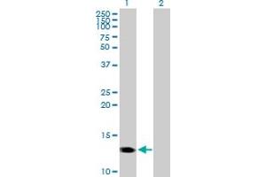 Western Blot analysis of CMTM1 expression in transfected 293T cell line by CMTM1 MaxPab polyclonal antibody. (CMTM1 Antikörper  (AA 1-114))
