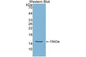 Detection of Recombinant HTRA1, Escherichia coli using Polyclonal Antibody to High Temperature Requirement Factor A1 (HTRA1) (HTRA1 Antikörper  (AA 304-442))