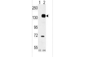 Western blot analysis of TEK (arrow) using rabbit polyclonal TEK Antibody (C-term) (ABIN392059 and ABIN2841824).