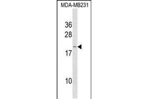 Western blot analysis in MDA-MB231 cell line lysates (35ug/lane). (IFNA6 Antikörper  (C-Term))