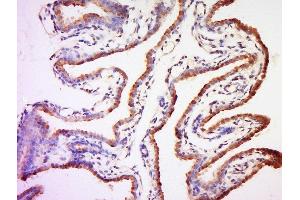 Formalin-fixed and paraffin embedded mouse placenta labeled with Anti-MC4 Receptor Polyclonal Antibody, Unconjugated  at 1:200 followed by conjugation to the secondary antibody and DAB staining. (MC4R Antikörper  (AA 1-50))